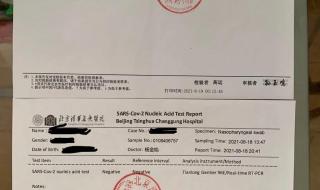 核算酸怎么检测结果有效期 核酸检测多久拿报告